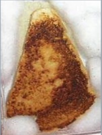 Source image for Overcooked Toast Slice Sizzling and Crumbling in Pan